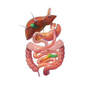 Gastric Bypass Graphic
