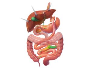 Diagram showing gastric bypass surgery