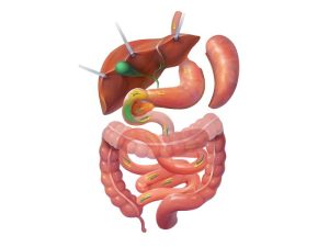Diagram showing gastric sleeve surgery